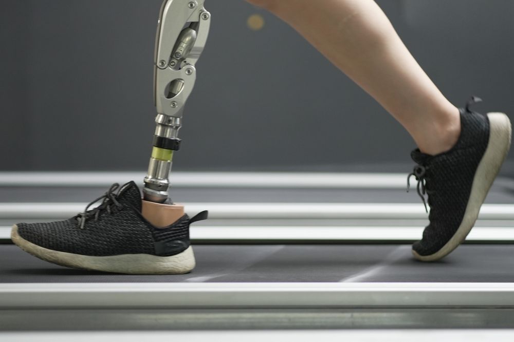 A person with a prosthetic leg is running on a treadmill.