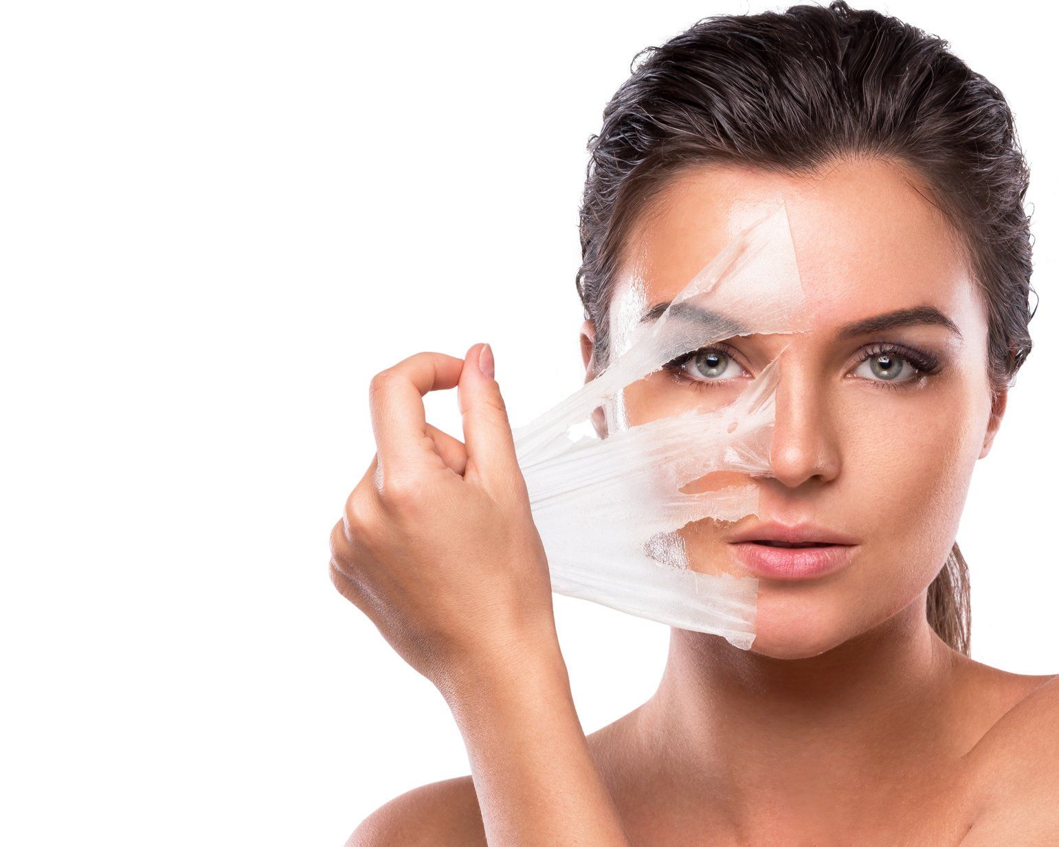 Chemical Peels in Natomas