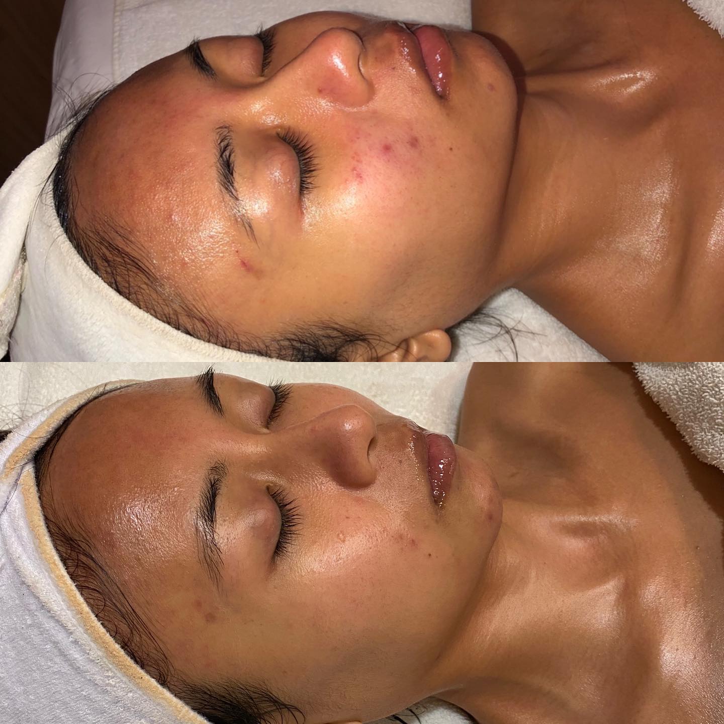 Healthy Glow gallery 12