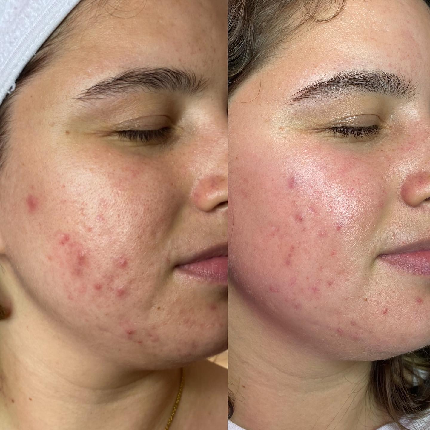 Healthy Glow gallery 3