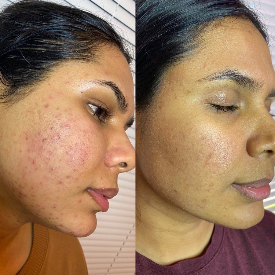 Healthy Glow gallery 2