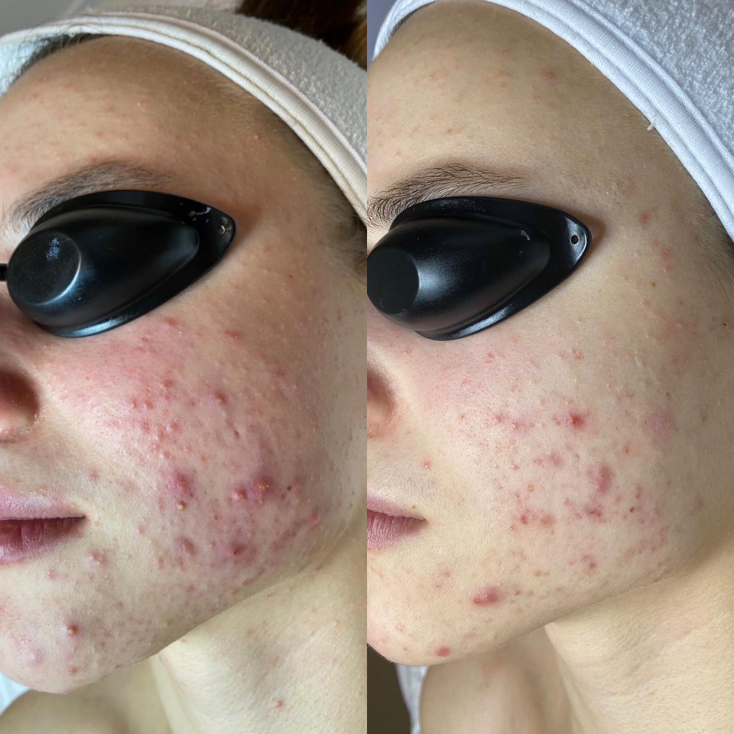 Healthy Glow gallery 8