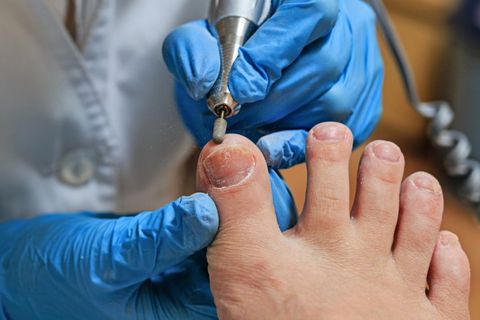 Podiatrist doing a foot procedure — Diabetic foot care in Westborough, MA