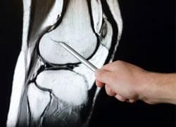 Médico ortopedista y traumatólogo