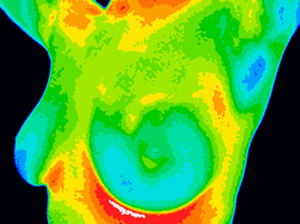 Breast Thermology