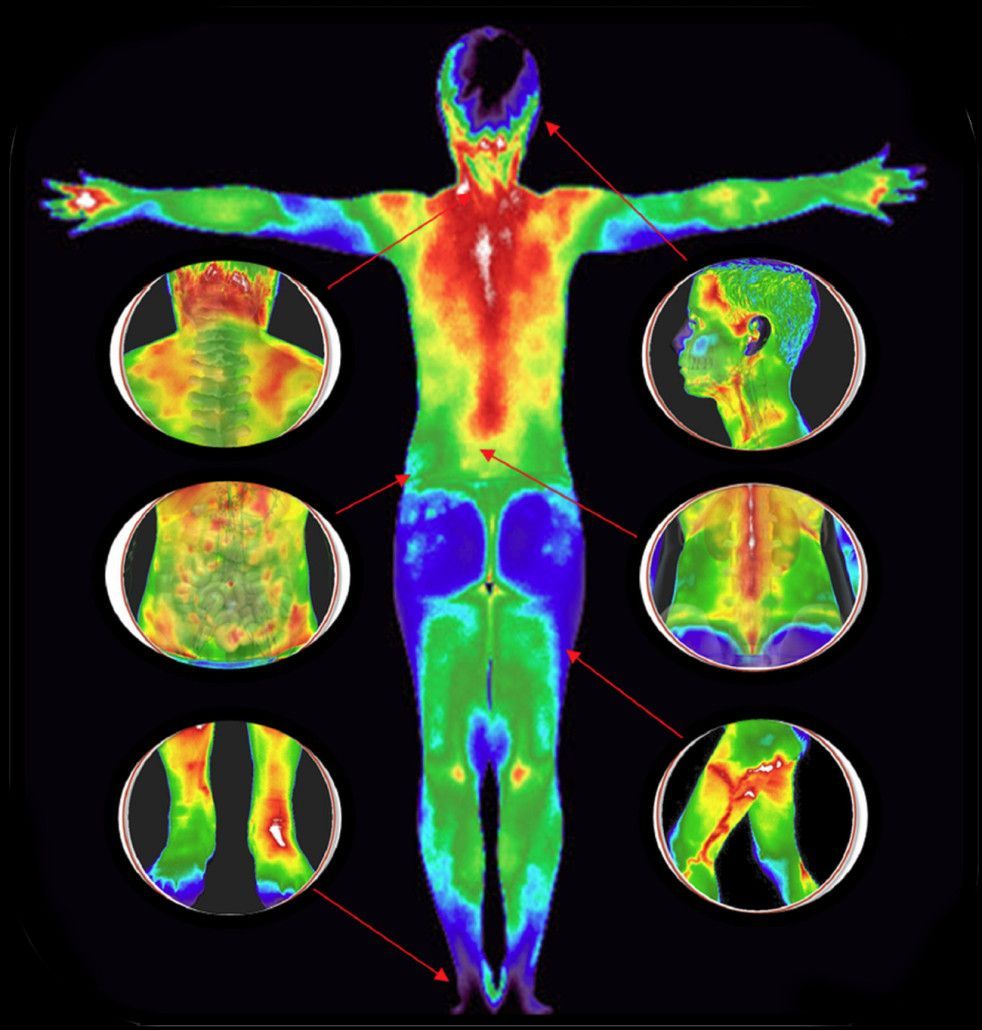Full Body Thermography