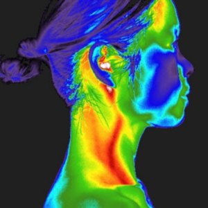 Head & Neck Thermography