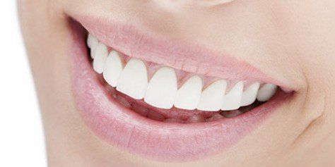 Perfect Smile — Dental Cleaning in Louisville, CO.