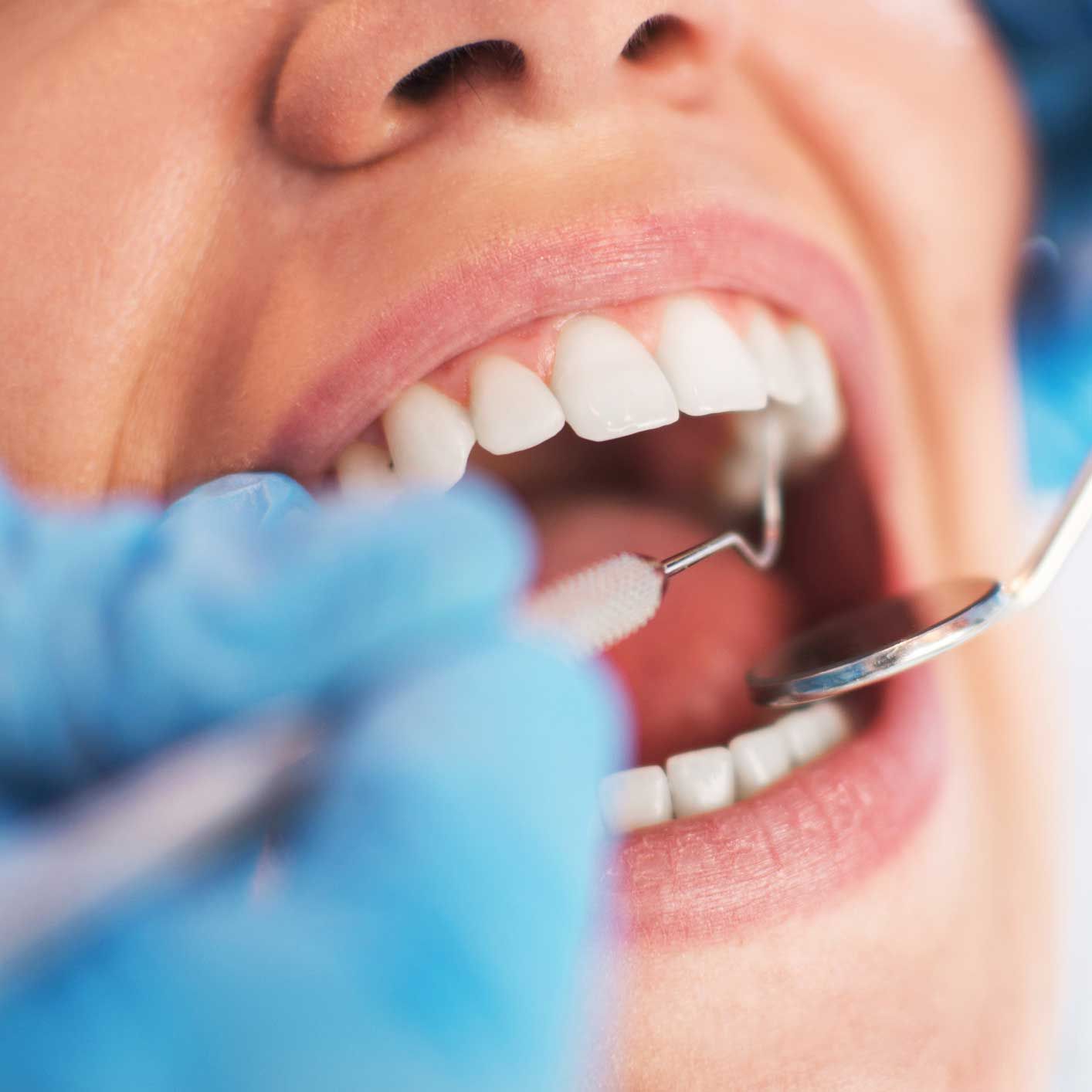 Dentist examining a patient's teeth with a mirror and probe. Focus on the open mouth and tools.