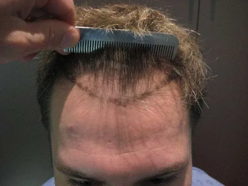 A woman is getting her eyebrows done at a beauty salon.