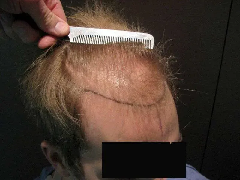 A woman is getting her eyebrows done at a beauty salon.