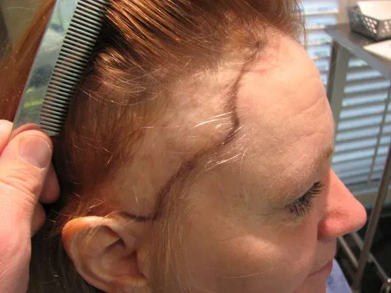 A woman is getting her eyebrows done at a beauty salon.