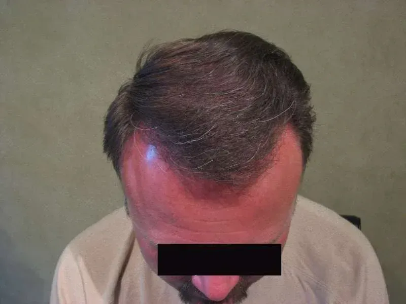 A woman is getting her eyebrows done at a beauty salon.