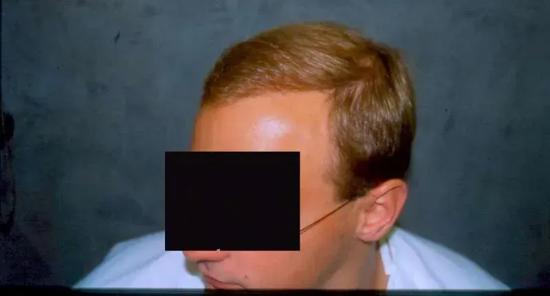 A woman is getting her eyebrows done at a beauty salon.