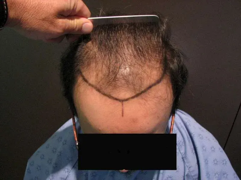 A woman is getting her eyebrows done at a beauty salon.