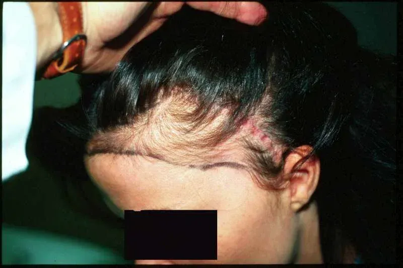 A woman is getting her eyebrows done at a beauty salon.