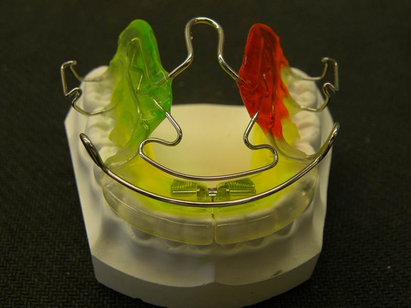 Orthodontic Appliances Sydney, NSW Macono Orthodontic & Dental