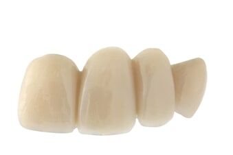 Ceramic Bridge - Cosmetic Dentists in Terre Haute, IN