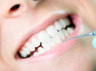 Dental Cleaning - Teeth Whitening in Terre Haute, IN