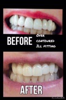 Teeth Treatment — Dentistry in Terre Haute, IN