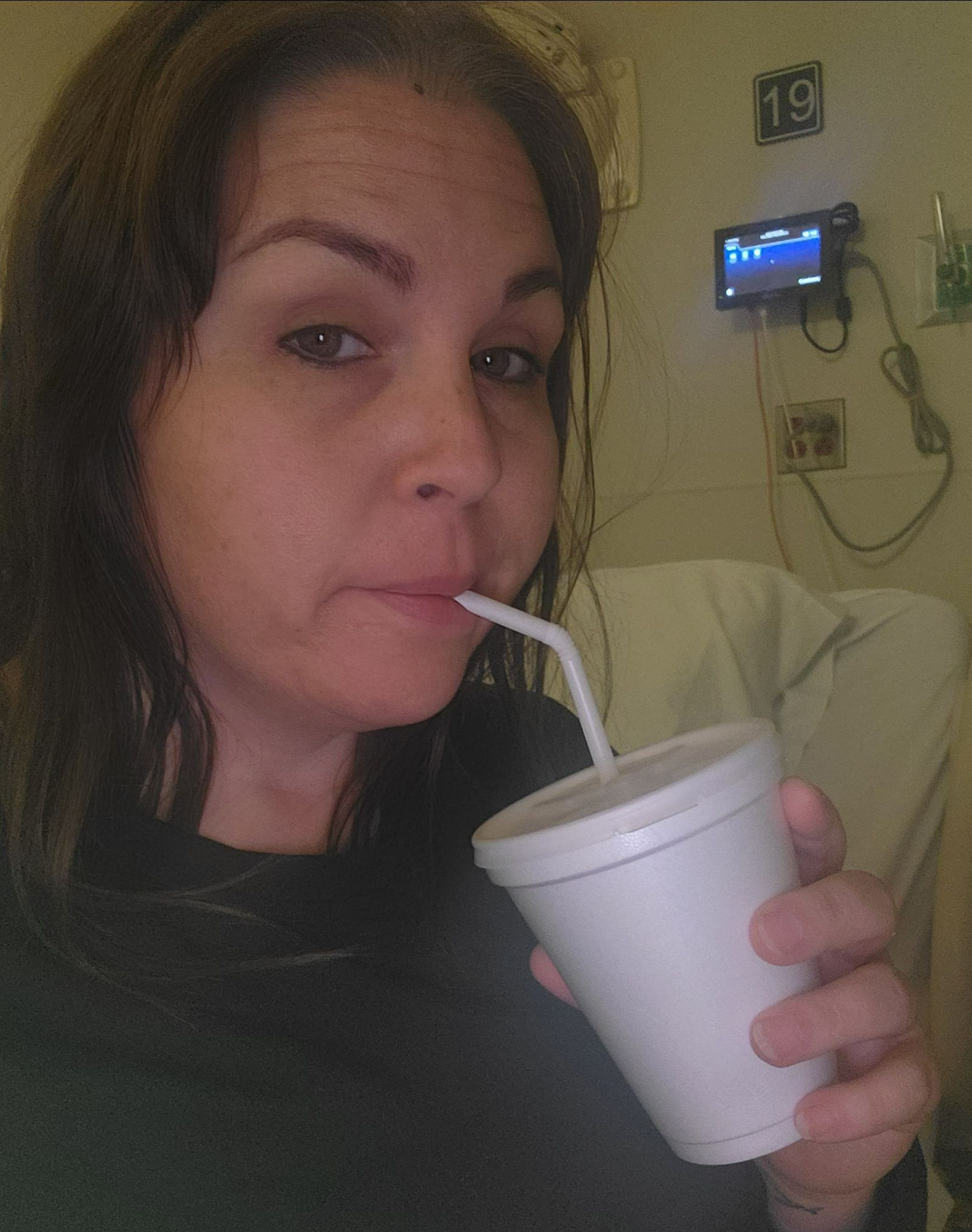 alex drinks from a straw post surgery