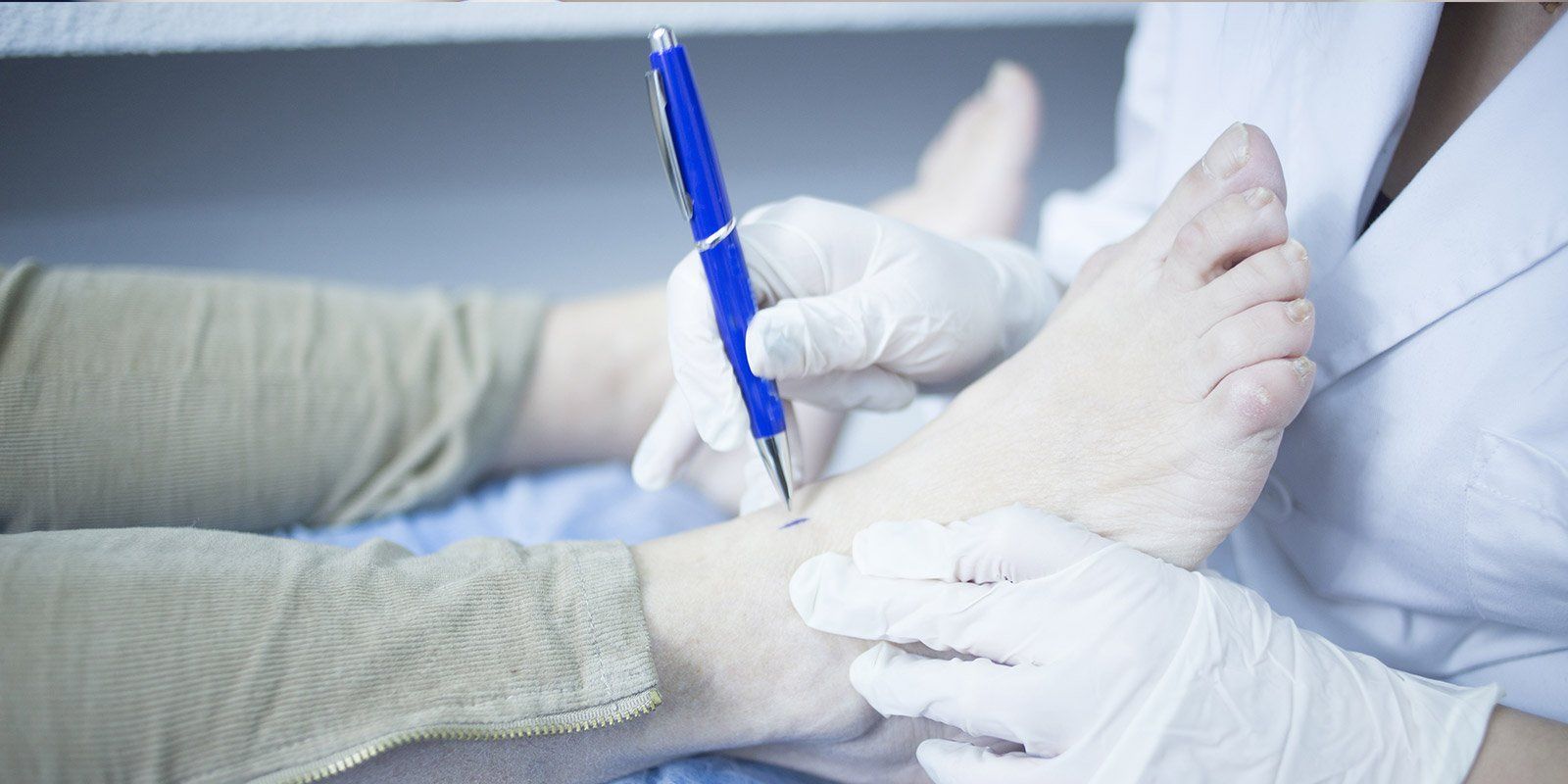Medico esamina il piede bianco di un paziente