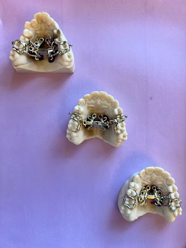 MARPE: The Greatest New Treatment in Orthodontics