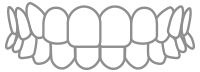 Black-and-white line drawing of a human mouth with teeth showing, front view