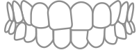 Black-and-white line drawing of a smiling mouth with teeth and braces, front view