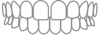 Outline of a human teeth set, front view, showing upper and lower teeth in gray line art