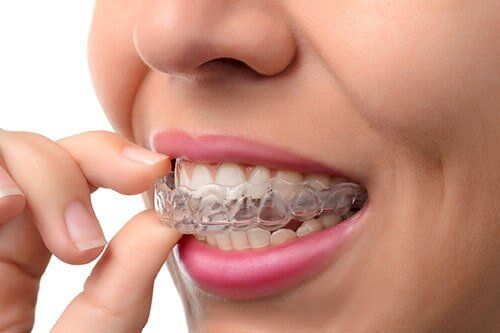 Orthodontic Silicone Trainer — Dental Services in Victorville, CA