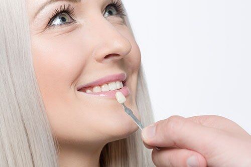 Teeth Whitening — Dental Services in Victorville, CA