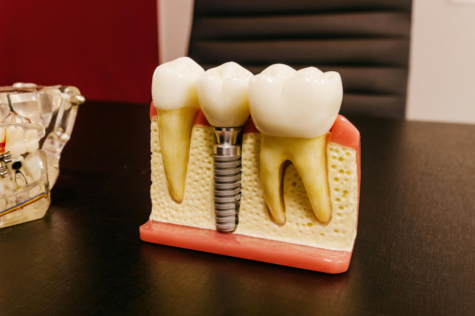 A model of a dental implant is sitting on a table.