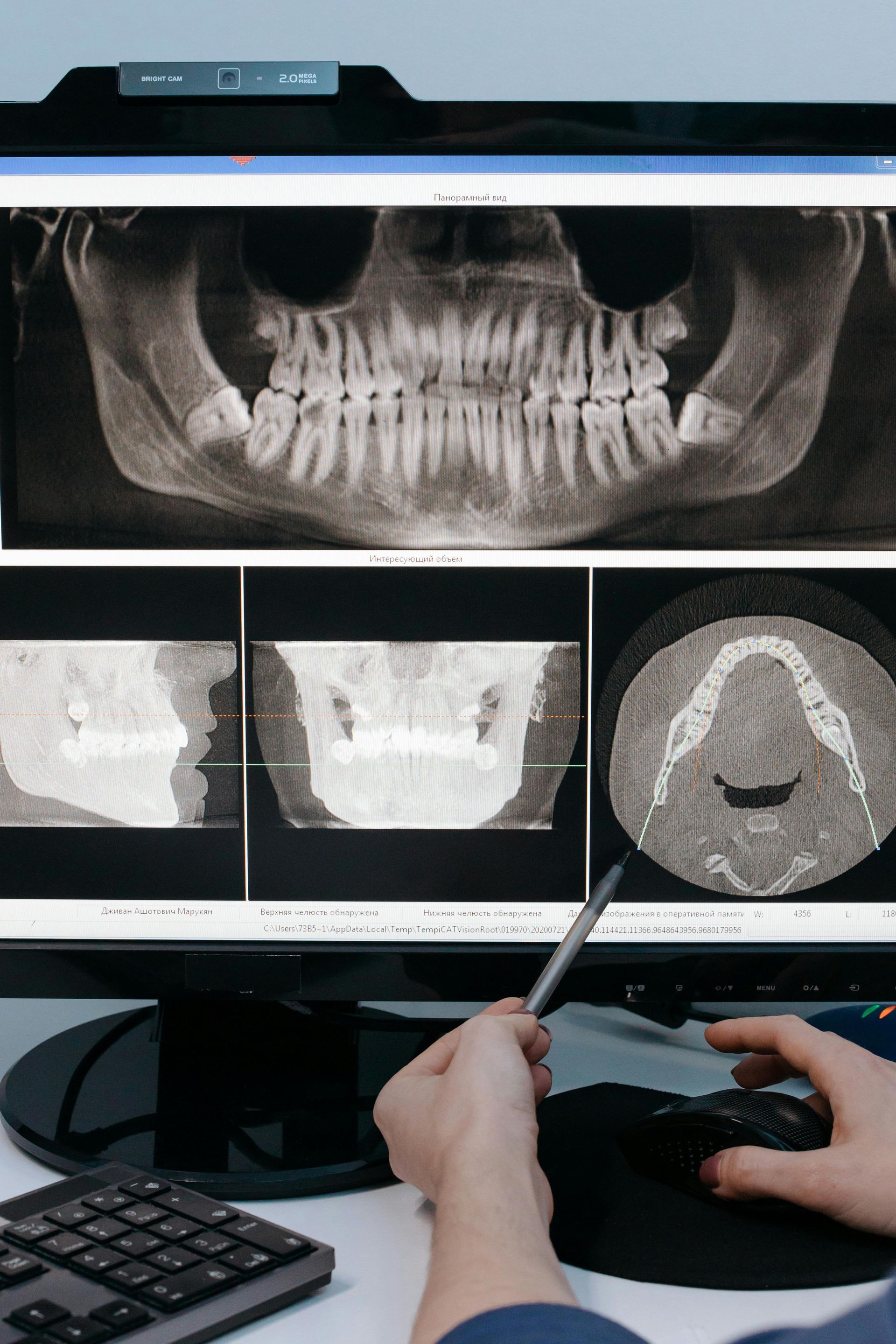 A person is looking at an x-ray of a skull on a computer screen.