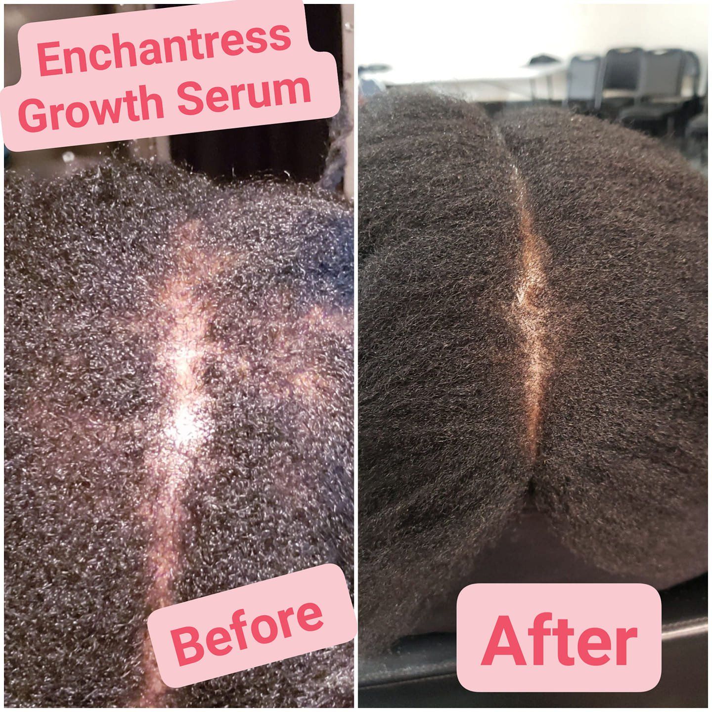 Before And After | Kansas City, MO | Enchantress Beaute Bar