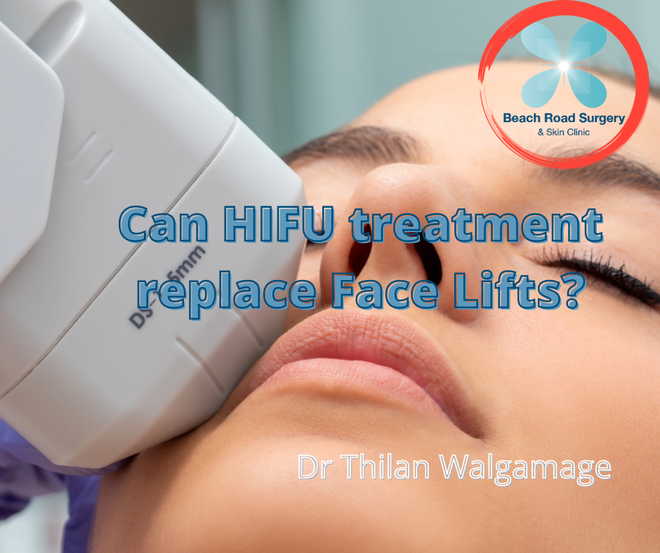 Can HIFU treatment replace Face Lifts?