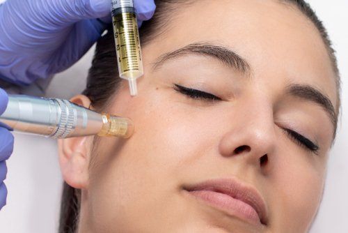 Collagen Induction Therapy or MICRONEEDLING