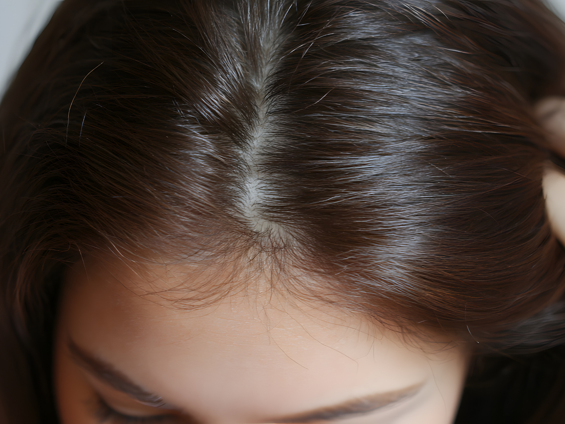 Close-up of brown hair parted, revealing scalp.