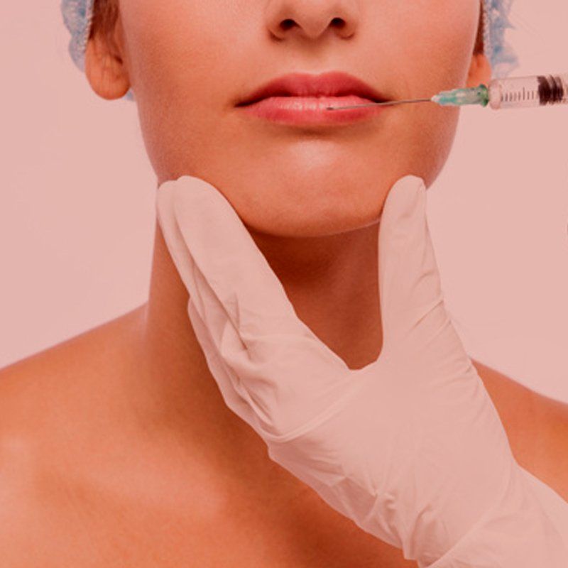 Preenchimento Labial