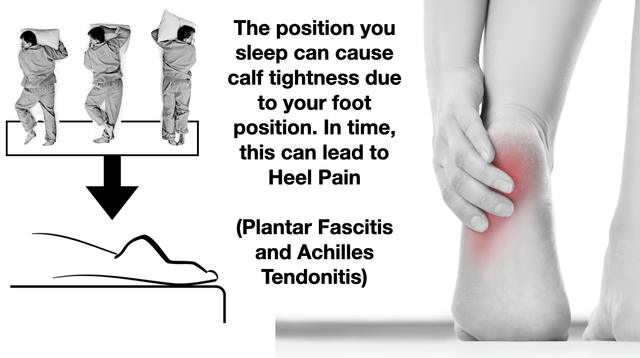 Achilles Tendonitis & Plantar Fasciitis