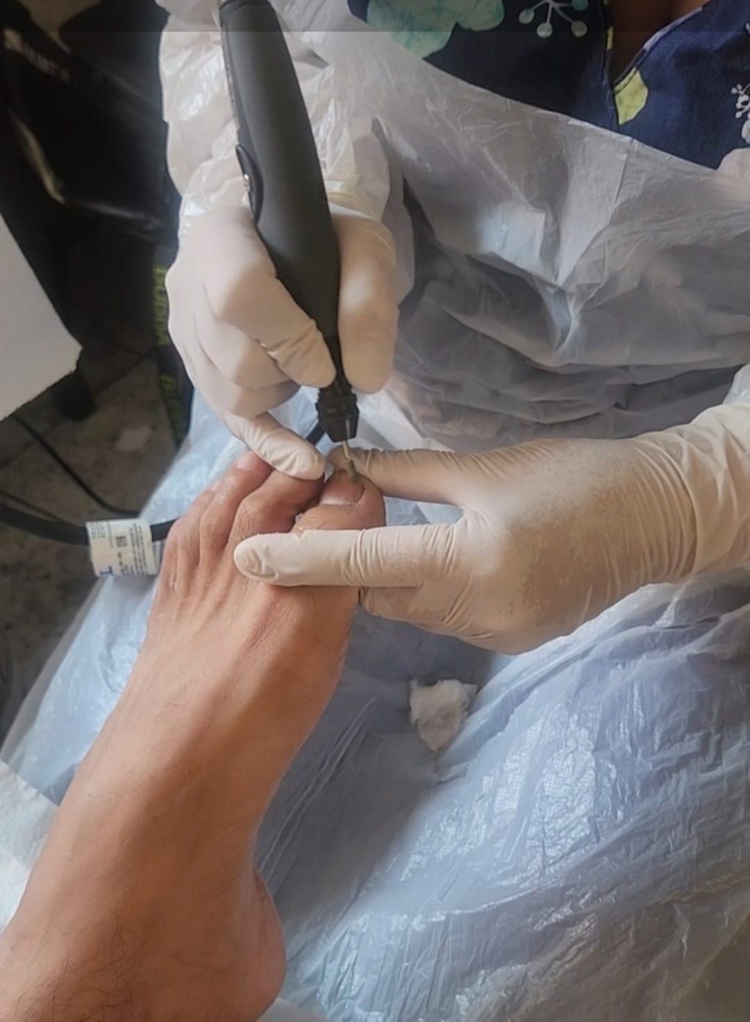 servicio de podología a domicilio