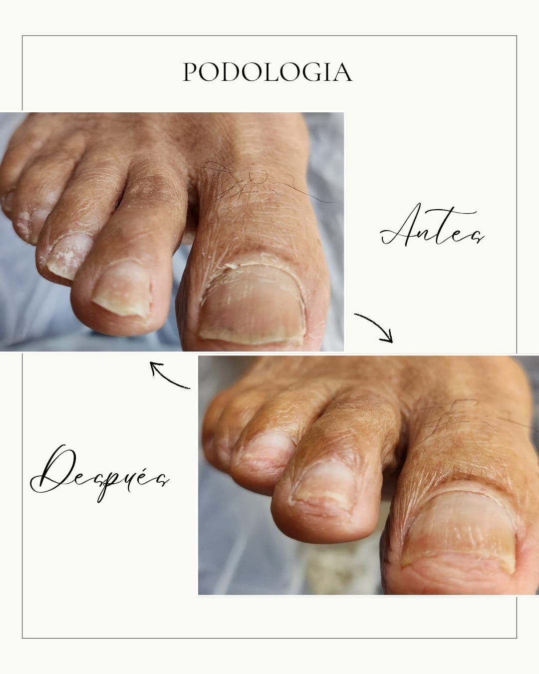 podología a domicilio