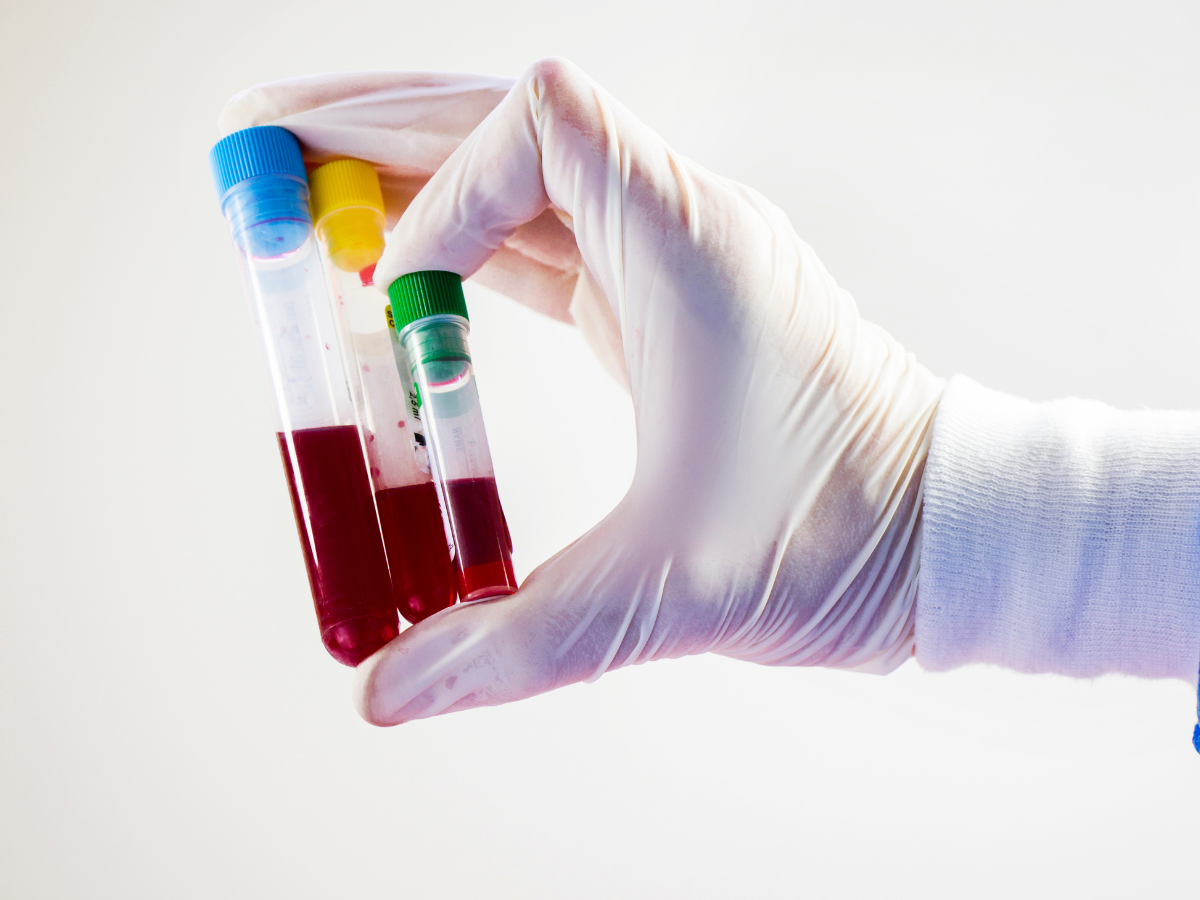 doing Routine Blood test