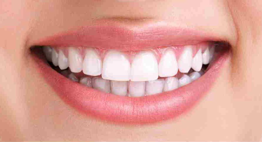 Primer plano de una boca sonriente con dientes blancos brillantes y labios rosados.