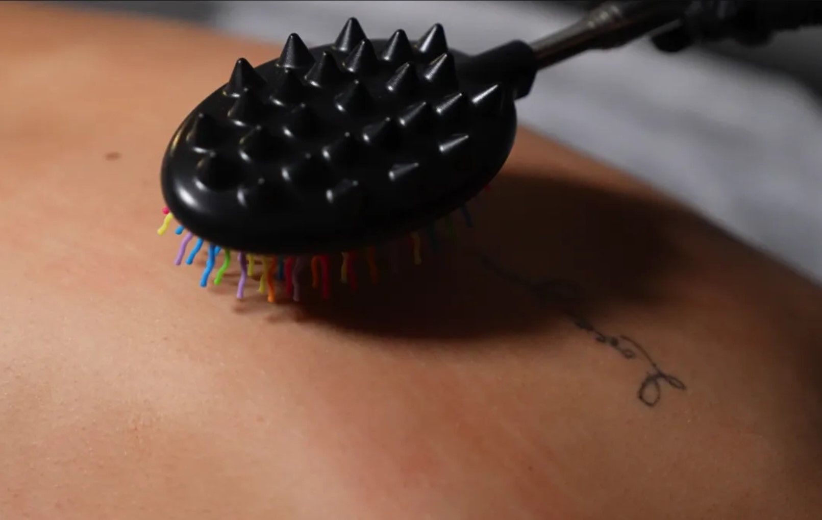 A black device with multicolored spikes on a person's back, near a tattoo, during a treatment.