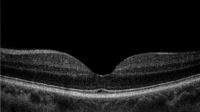 Ricostruzione al computer della struttura retinica 2