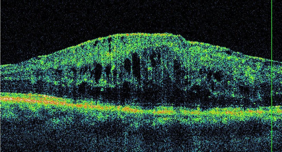 Ricostruzione al computer della struttura retinica