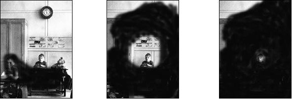 Perdita visione per glaucoma