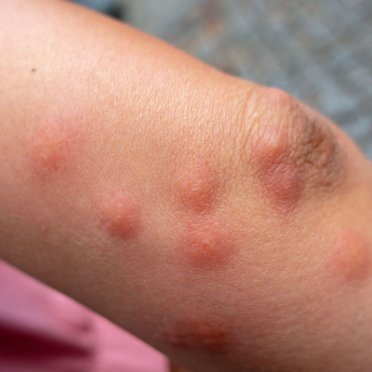 A close up of a scorpion on a rock.