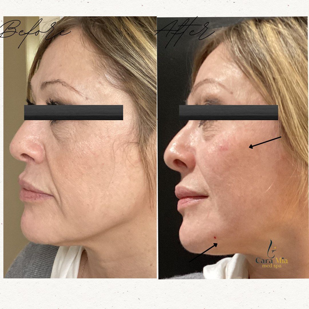 A before and after photo of a woman 's face
